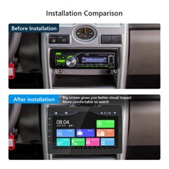 10.1″ 1 DIN Car Stereo Radio Apple Carplay Android Auto Bluetooth FM USB AUX